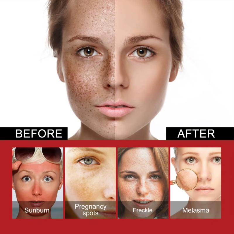 Powerful Spot-Removing Whiten  - Charcoal Whitening Paste 评论和价格