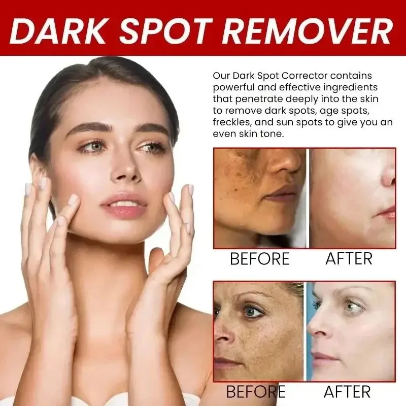 Powerful Spot-Removing Whiten  - Charcoal Whitening Paste 评论和价格
