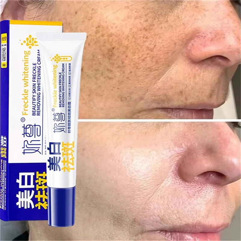 Powerful Spot-Removing Whiten  - Charcoal Whitening Paste 评论和价格