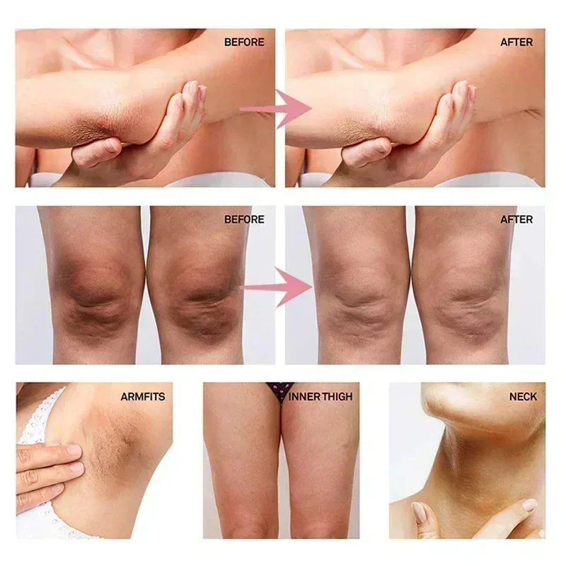 Collagen Underarm Whitening Cr - Charcoal Whitening Paste 评论和价格