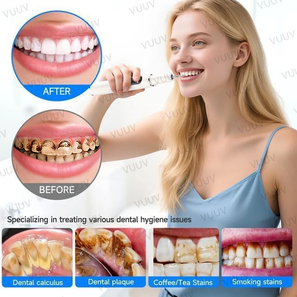 VUUV Ultrasonic Teeth Cleaner  - Teeth Whitening Uv 评论和价格