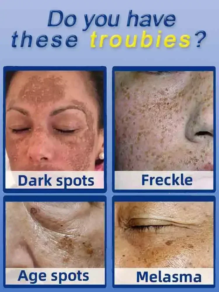 Dark Spot Remover for Face Rem - Charcoal Whitening Paste 评论和价格