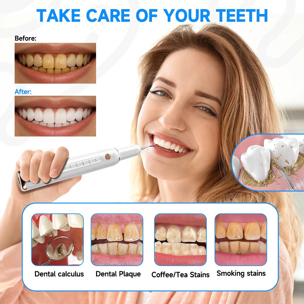 CURVY MOON T4 Portable Ultraso - Teeth Whitening Uv 评论和价格