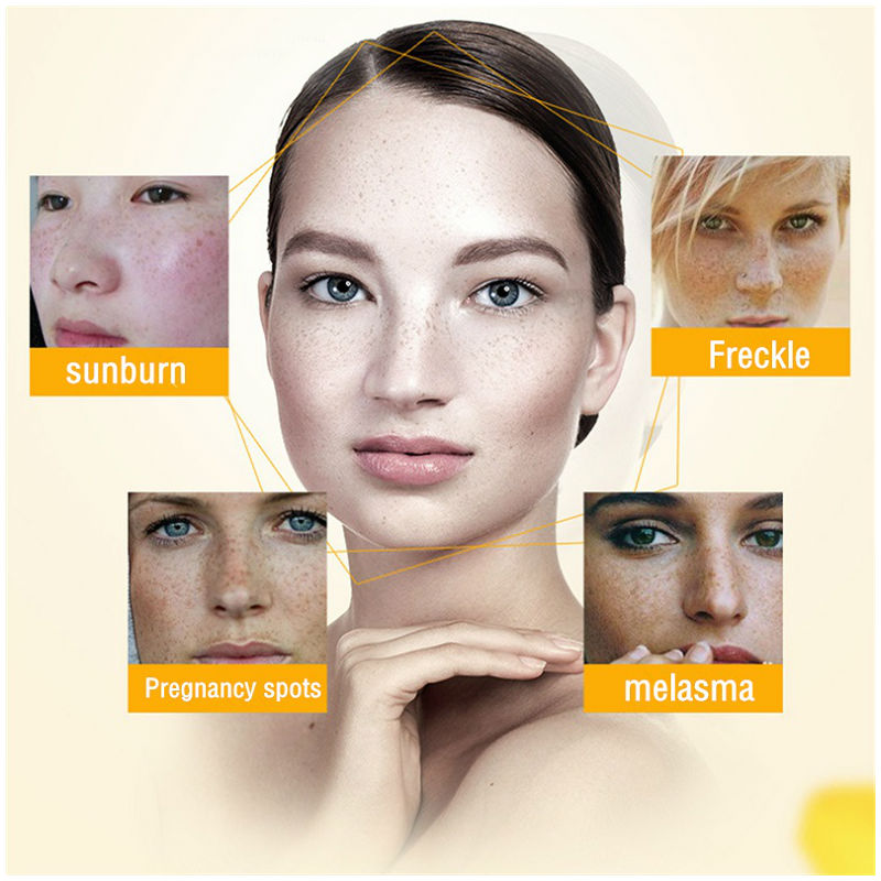 Dimollaure Whitening Freckle C - Charcoal Whitening Paste 评论和价格