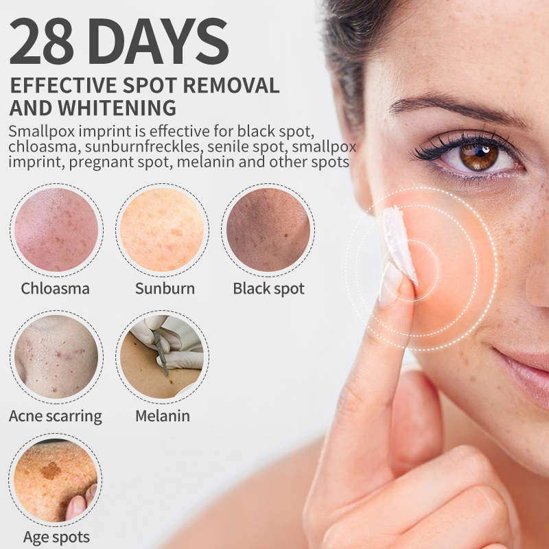 Dimollaure Whitening Freckle C - Charcoal Whitening Paste 评论和价格