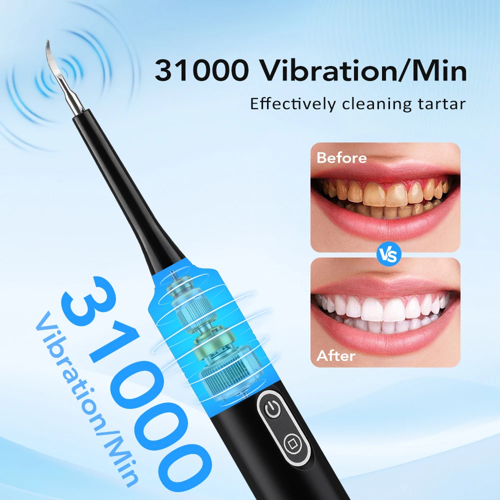 Electric Sonic Vibration Denta - Teeth Whitening Kit Professional 评论和价格